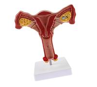 1:1 Humain UtéRus Ovaire Trompes de Fallope Modèle Anatomique Anatomie Humaine Modèle Outils PéDagogiques