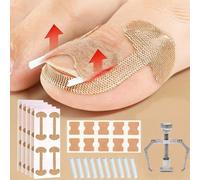 1/10/17pcs/Set Tampons de remplissage pour ongles incarnés Autocollants de correction des ongles Outils pour ongles incarnés Amélioration sans douleur Pour tous les types de soins des pieds Polyester