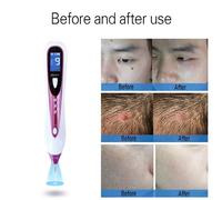 1 Ensemble Laser Tache De Rousseur Enlevement Stylo Soins De La Peau Taupe Fonce Tache Decapant Stylo Pour Visage Verrue Etiquette Tatouage Salon Beaute Machine