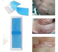 1 Pieces Auto-Adhesif Impermeable Cicatrice Reparation Pate Silicone Medical Patch Peau Gel Cicatrice Therapie Patch Soutien Vente En Gros Et Livraison Directe