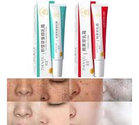1 Set Dark Spot Remover for Face,Melanin Correcting Facial Serum,Dark Spot Correcting Glow Sérum - Éclaircissant et hydratant, traitement anti-hyperpigmentation, anti-âge (1set)