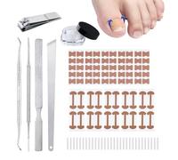 105 PCS Ingrown Toenail Corrector Set, Breathable Nail Correction Patch, Ingrowing Toenail C-pads With Nail Clippers, Professional Ingrown Toenail Tool For Toenail Care Relieving Pain