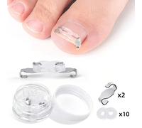 12/24pcs Kit de correction d'ongles incarnés, pinces de redressement des ongles, orthèse pour ongles enroulés, patchs de traction pour redresser les ongles d'orteils, pinces à ongles, outils de soin d