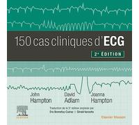 150 cas cliniques d'ECG