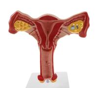 1pc 1:1 Humain Femelle Utérus Ovaire Trompes De Fallope Modèle Anatomique Modèle D'anatomie Humaine Outils D'enseignement Médical