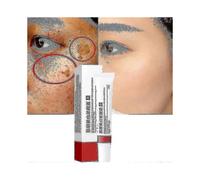 (1pcs)Huiyun Cream To Remove Melasma And Melanin - 2023 Skin Care By Changzhao - In S And L Sizes Tw