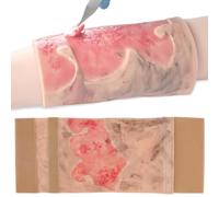2-3 Degree Limb Burns Training Module, Simulated Burn Wound Model, Wound Skin Model, Wearable + Reusable, Learn About Burn Care, for Medical Students Practice Teaching Demonstration