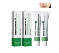 2 Pcs Whitening Freckle Cream, Spot-off Freckle Whitening Cream, Remove Melasma Cream, Acne Scar Removal Cream, Remove Melasma Melanin Dark Spots, Skin Whitening Cream (2 Acne Cream)