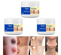 2024 Nouvelle Crema Para Manchas Oscuras En La Cara, 50g Contient Du Collagène Et De L'acide Hyaluronique Crème Hydratante Pour Le Visage, Adecuado Para Varias Áreas Como Cara, Axilas, Cuello, Zona Pr