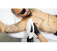 3 séances d épilation à la lumière pulsée sur une petite zone au choix