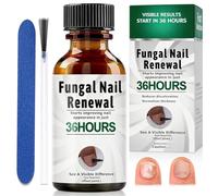 30ml Soin Ongles Des Pieds,Sérum de Soin des Ongle Nourrissant,Nourrissage pour Ongles Fragiles,Pour le Soins et Quotidienne Pour Ongle,Amélioration Apparence, Pour Les Hommes et Les Femmes