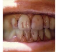 31 Knots - Take Like Blood