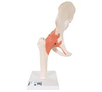 3B Scientific A81/1 Modèle Fonctionnel de Luxe de l'Articulation de la Hanche + Application anatomie gratuite - 3B Smart Anatomy
