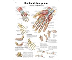 3B Scientific Affiche anatomique de la main et du poignet, anatomie et pathologies pour médecine, kinésithérapie et soins infirmiers