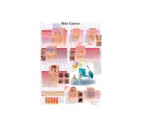 3B Scientific - Anatomie humaine - Cancer de la peau