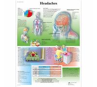 3B Scientific - Anatomie humaine - Maux de tête