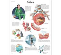 3B Scientific Anatomie humaine - Tableau d'asthme, version plastifiée