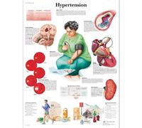3B Scientific Anatomie humaine - Tableau d'hypertension, version laminée
