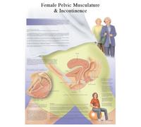 3B Scientific Anatomie humaine - Tableau d'incontinence urinaire féminine - Version plastifiée