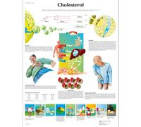 3B Scientific Anatomie humaine - Tableau du cholestérol - Version plastifiée