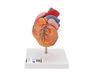 3B Scientific® Cœur Classique avec Hypertrophie Ventriculaire Gauche (HVG) - Modèle Anatomique Humain en 2 Parties Taille Réelle + Smart Anatomy App (Garantie de 5 Ans)