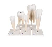 3B Scientific D10 Série de modèles de dents (Pack de 5) + Application anatomie gratuite - 3B Smart Anatomy