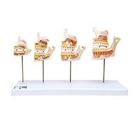 3B Scientific D20 Développement de la Dentition + Application anatomie gratuite - 3B Smart Anatomy