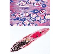 3B Scientific GmbH W13323S Lot de 50 lames de microscope en espagnol