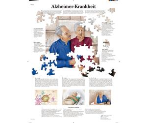 3B Scientific Graphique de la maladie d'Alzheimer, 1