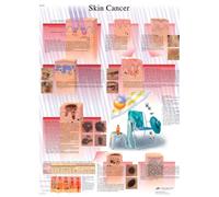 3B Scientific Human Anatomy Tableau contre le cancer de la peau, version plastifiée