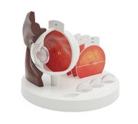 3B Scientific Œil pathologique agrandi 5 fois, peau foncée - 3B Smart Anatomy
