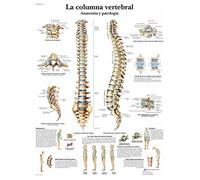 3B Scientific Imprimé sur papier, colonne vertébrale, anatomie et pathologie, 1