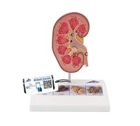 3B Scientific K29 Modèle de Calcul Rénal + Application anatomie gratuite - 3B Smart Anatomy