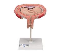 3B Scientific L10/6 Fœtus à 5 Mois, Décubitus Dorsal + Application anatomie gratuite - 3B Smart Anatomy