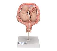 3B Scientific L10/7 Fœtus Jumeaux à 5 Mois, Position Normale + Application anatomie gratuite - 3B Smart Anatomy