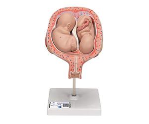 3B Scientific L10/7 Fœtus Jumeaux à 5 Mois, Position Normale + Application anatomie gratuite - 3B Smart Anatomy
