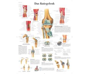 3B Scientific - Laminé Articulation du Genou Affiche - Anatomie & Pathologie - Poster Protégé contre UV et Poussière pour Étude, Enseignement et Cliniques