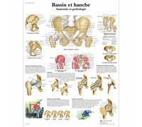 3B Scientific VR2172L Planche Anatomique, Bassin et Hanche, Anatomie et Pathologie
