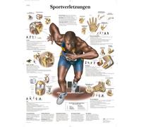 3B Scientific - Laminé Blessures Sportives Affiche - Poster d’Anatomie Protégé contre UV et Poussière pour Étude, Enseignement et Cliniques