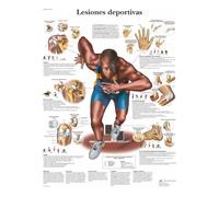 3B Scientific - Laminé Blessures Sportives Affiche - Poster d’Anatomie Protégé contre UV et Poussière pour Étude, Enseignement et Cliniques