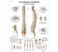 3B Scientific vr4152l la colonne vertébrale, anatomie et pathologie, 1