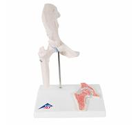 3B Scientific® Mini Modèle d’Articulation de la Hanche - Hanche Humaine Demi-Taille Réelle avec Coupe Transversale pour Enseignement Anatomique + Smart Anatomy App (Garantie de 5 Ans)