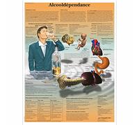 3B Scientific Modèle Anatomique Alcool dépendance