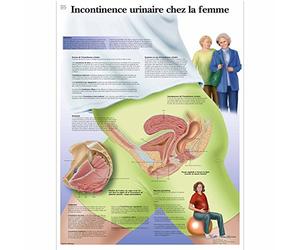 3B Scientific Modèle Anatomique Incontinence Urinaire Chez la Femme