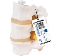 3B Scientific® Modèle de 3 Vertèbres Lombaires - Segment Vertébral Taille Réelle avec Disques Intervertébraux, Montage Flexible + Smart Anatomy App (Garantie de 5 Ans)