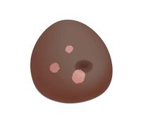 3B Scientific® Modèle Mammaire Sonotrain avec Tumeurs - Peau Foncée, Simulateur mammaire à ultrasons et diagnostique pour la formation à la détection des tumeurs