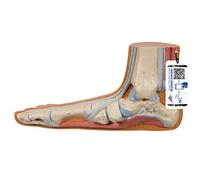 3B Scientific M31 Pied Plat, Pes Planus + Application anatomie gratuite - 3B Smart Anatomy