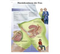 3B Scientific Planche anatomique en allemand sur laminé - Incontinence urinaire de la femme, 1