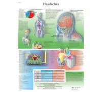 3B Scientific Tableau 3B Scientific Maux de tête laminé, Plastifié, 1