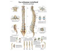 3B Scientific Tableau éducatif de la colonne vertébrale en espagnol, anatomie et pathologies, support d'enseignement médical, 50 × 67 cm